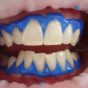 Tips To Choosing The Best Teeth Whitening Pens